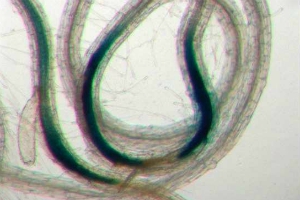 A zoomed in section of a plant parasite is displayed under a microscope