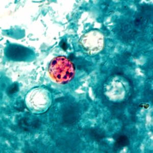 Presence of four cyclospora cayetanensis oocysts, zoomed on microscope, which look like three clear and one red orbs floating in blue water